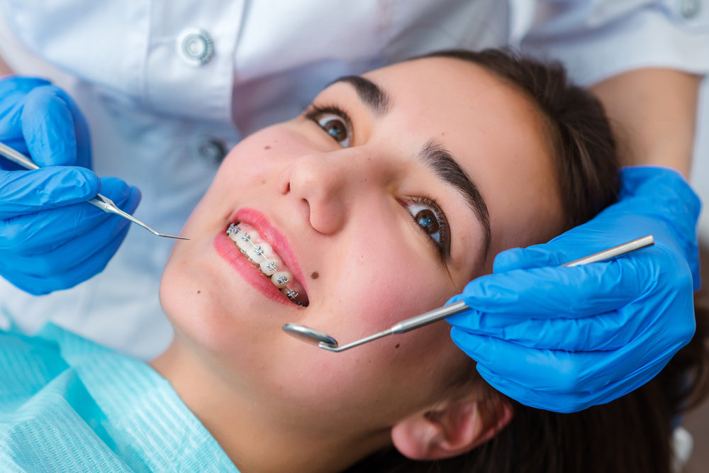 Braces Dentist Dublin Clear Braces for Adults and Kids