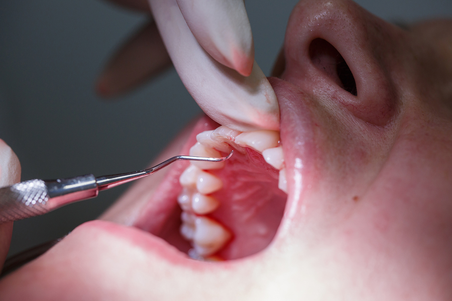 periodontics dental clinic services photo